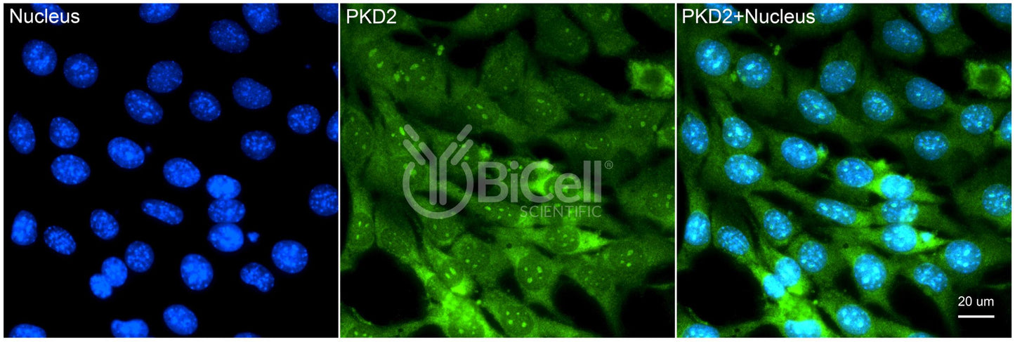 Polycystin-2 (PKD2) Monoclonal Antibody (G6 Clone) - FFPE Validated