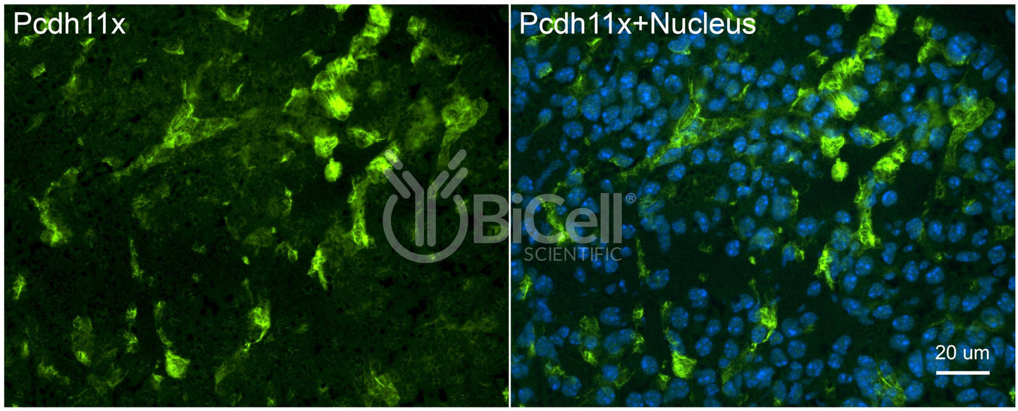 Protocadherin-11 X-linked (PCDH11X or PCDH11) Antibody - FFPE Validated