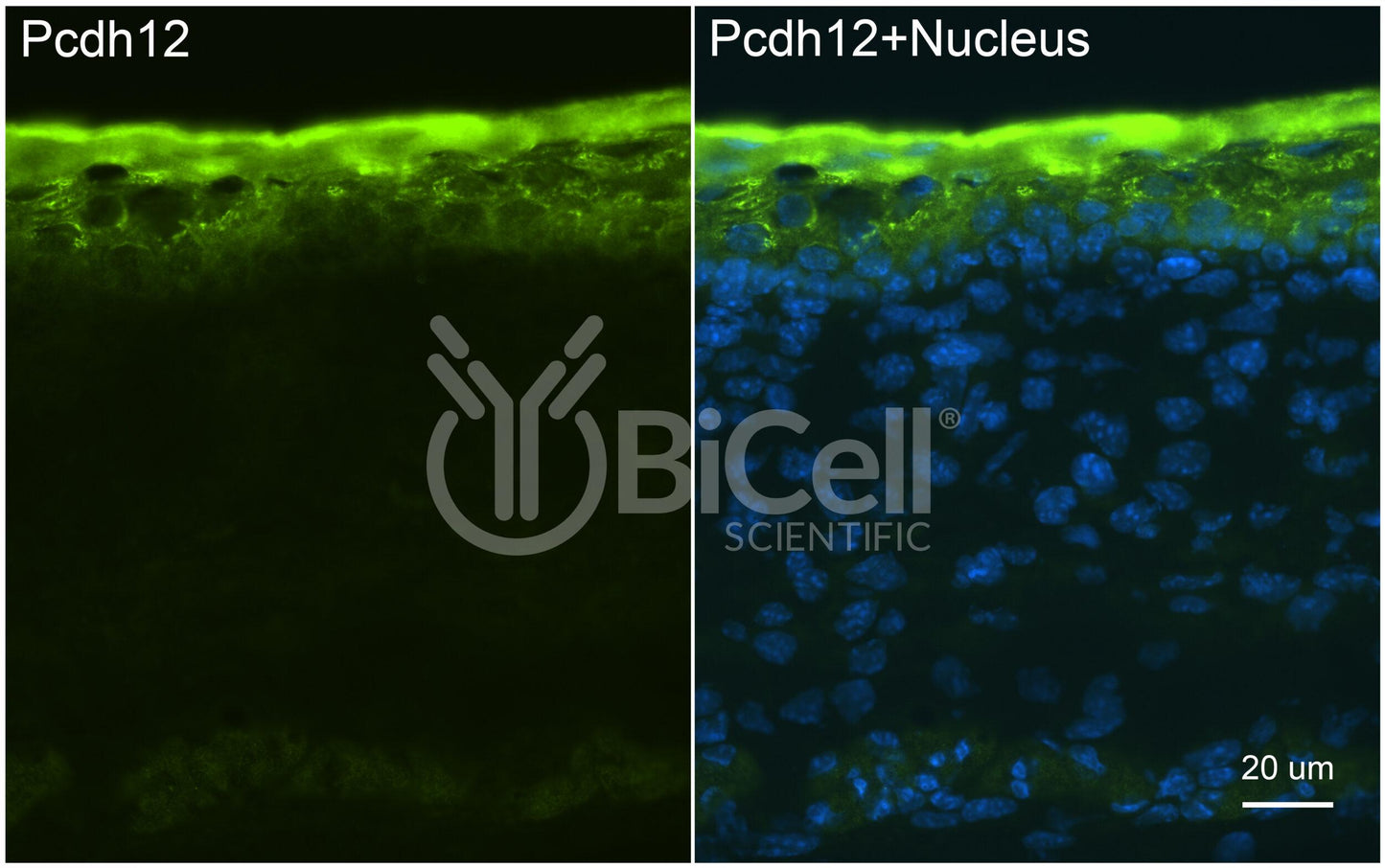 Protocadherin-12 (PCDH12 or VE-cadherin-2 or VECAD2) Antibody - FFPE Validated