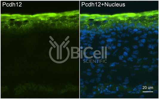 Protocadherin-12 (PCDH12 or VE-cadherin-2 or VECAD2) Antibody - FFPE Validated