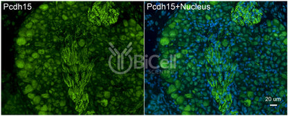 Protocadherin-15 (PCDH15 or CDHR15 or USH1F or DFNB23) Antibody - Western Blot Validated