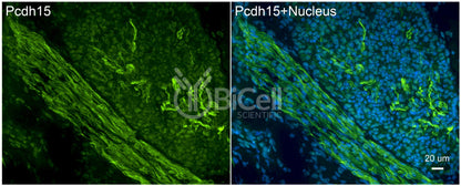 Protocadherin-15 (PCDH15 or CDHR15 or USH1F or DFNB23) Antibody - Western Blot Validated