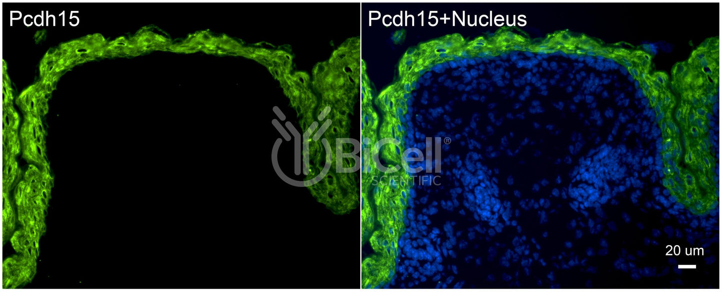 Protocadherin-15 (PCDH15 or CDHR15 or USH1F or DFNB23) Antibody - Western Blot Validated