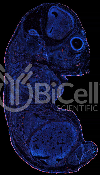 Protocadherin-15 (PCDH15 or CDHR15 or USH1F or DFNB23) Antibody - Western Blot Validated