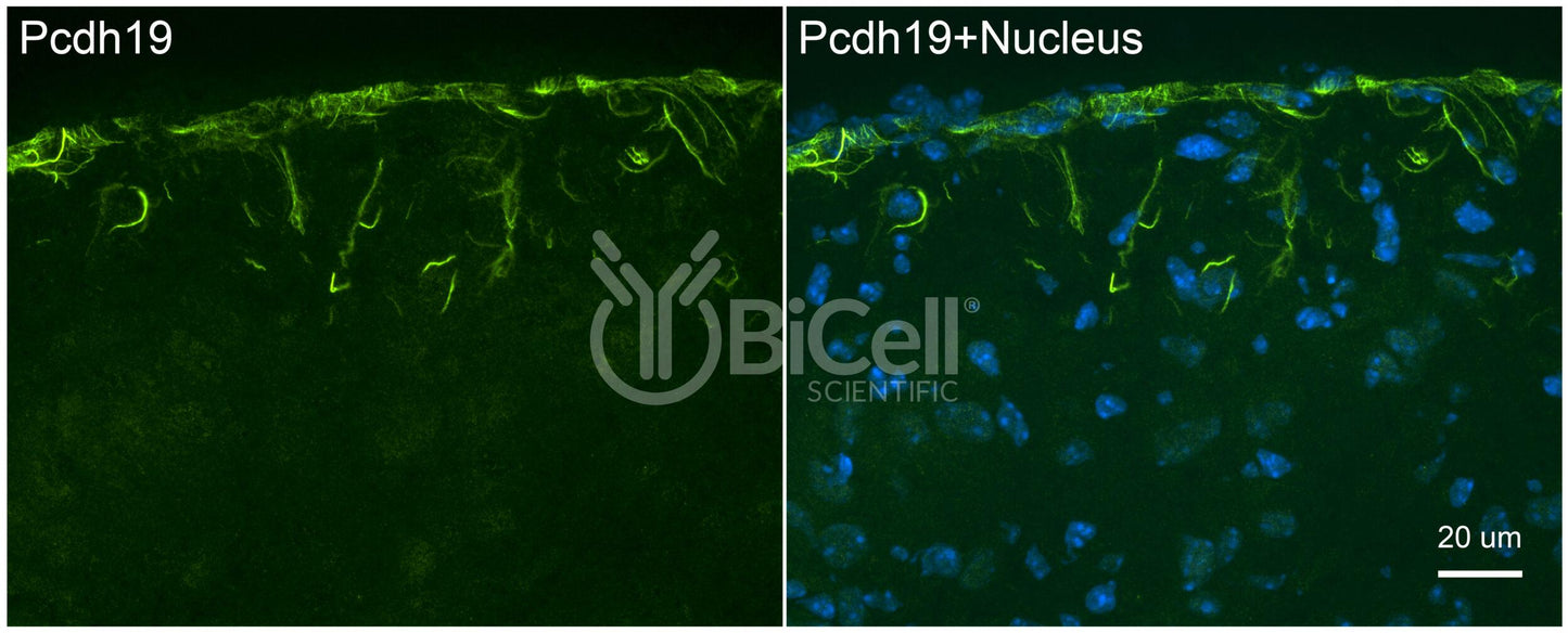 Protocadherin-19 (PCDH19 or DEE9 or EFMR) Antibody - FFPE Validated