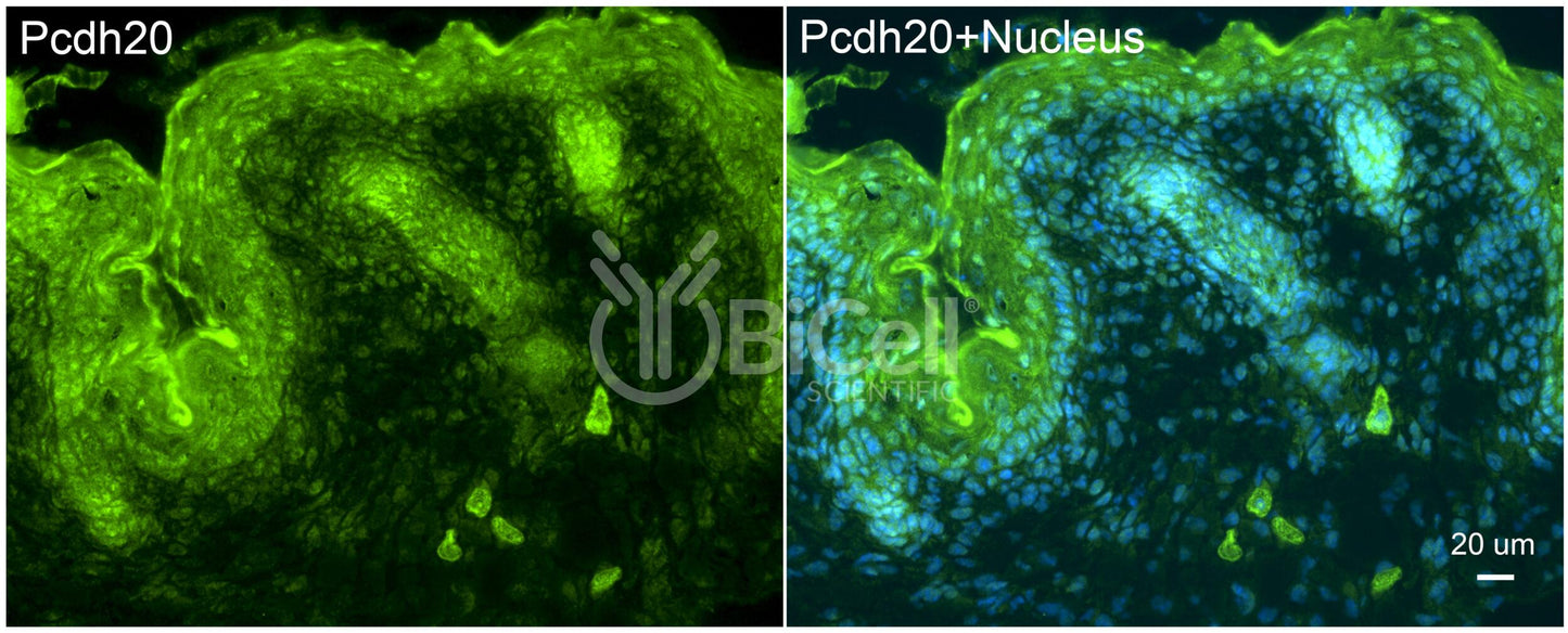 Protocadherin-20 (PCDH20 or PCDH13) Antibody - Western Blot Validated