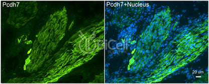 Protocadherin-7 (PCDH7 or BHPCDH) Antibody - FFPE Validated
