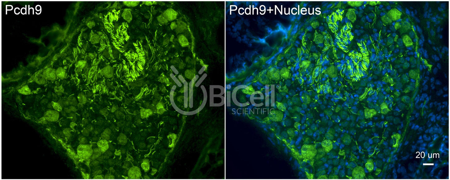 Protocadherin-9 (PCDH9) Antibody - FFPE Validated