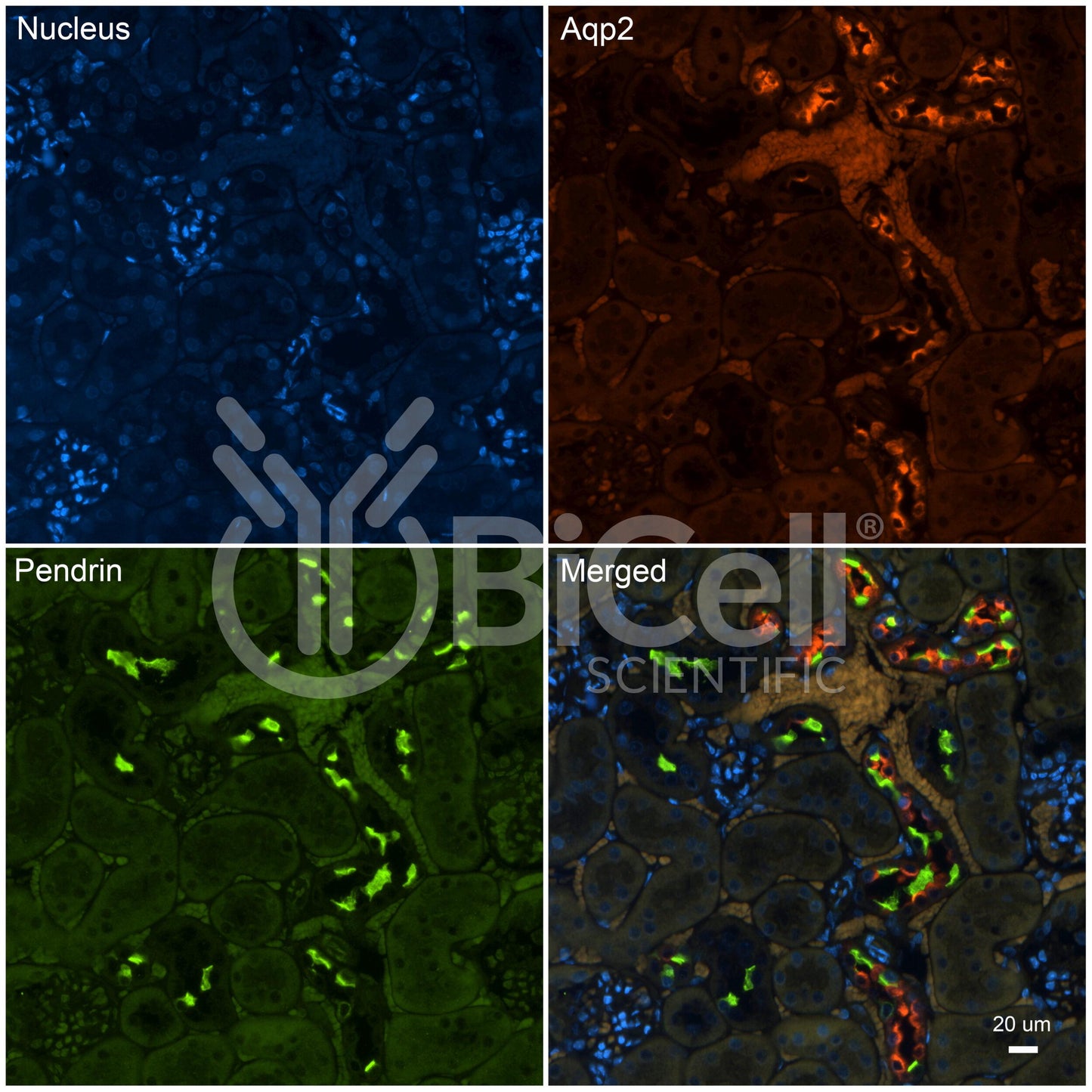 Pendrin (Slc26a4) Antibody