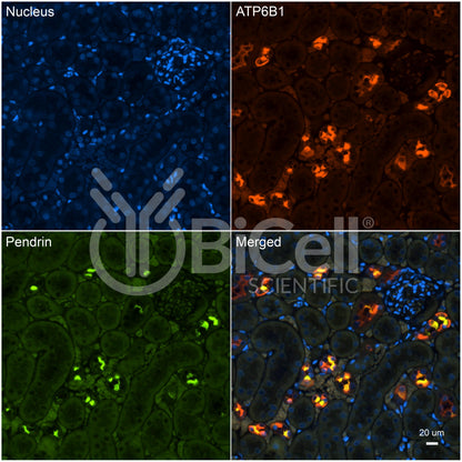ATP6V1B1 (ATP6B1) Antibody - Western Blot Validated