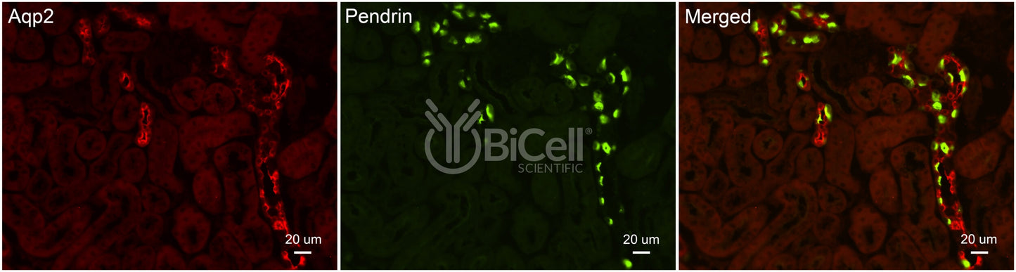 Pendrin (Slc26a4) Antibody - FFPE Validated