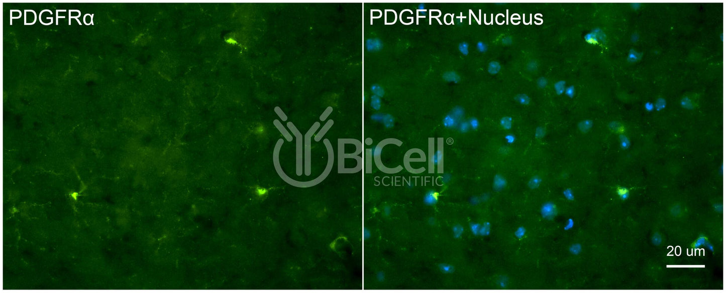 PDGFRA (CD140a) Antibody