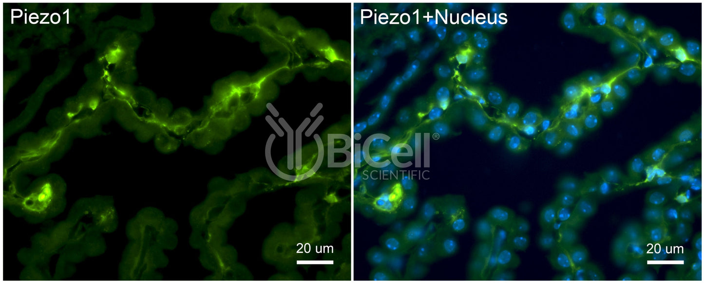 Piezo1 (Internal) Antibody - Western Blot Validated