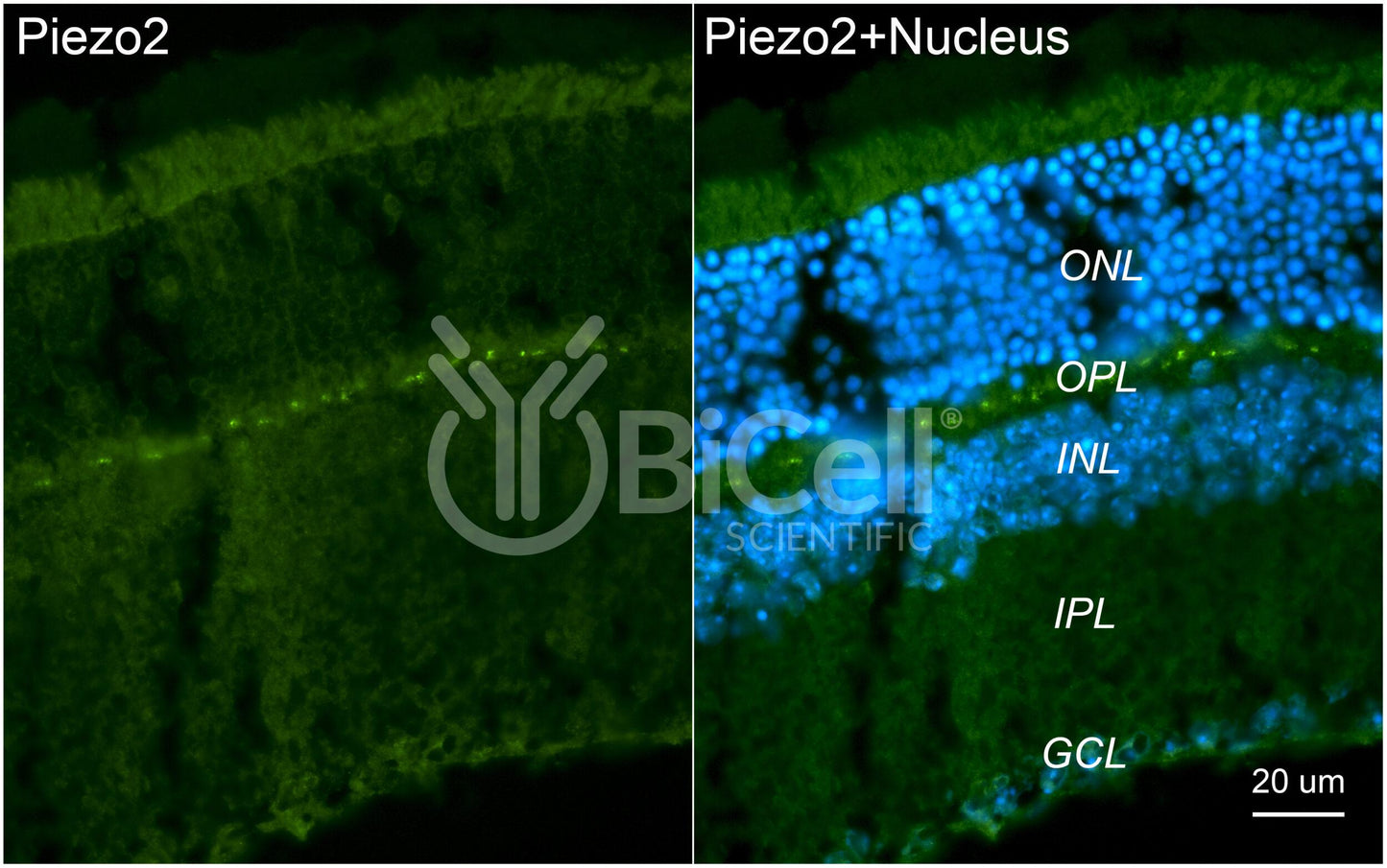 Piezo2 Antibody - Western Blot Validated