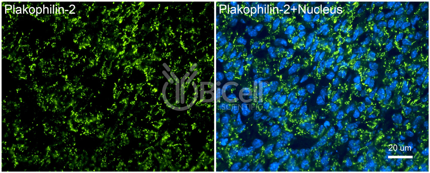 Plakophilin-2 (PKP2) Antibody - FFPE Validated