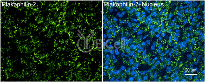 Plakophilin-2 (PKP2) Antibody - FFPE Validated