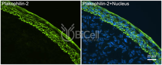 Plakophilin-2 (PKP2) Antibody - Western Blot Validated