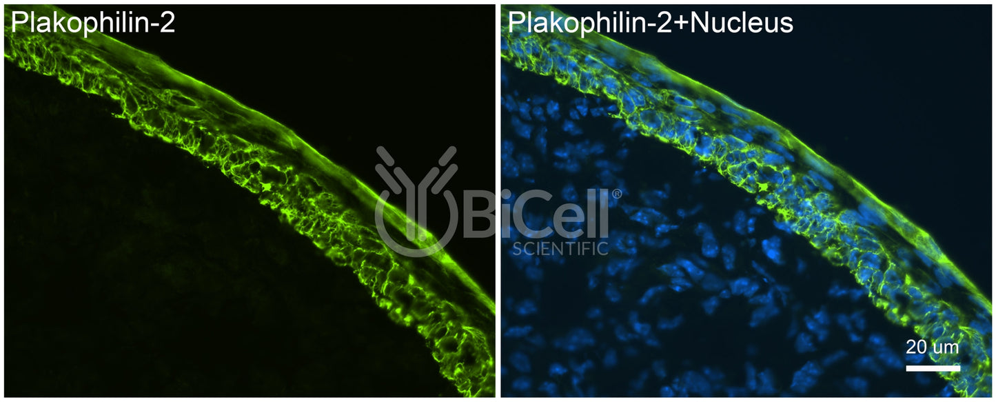 Plakophilin-2 (PKP2) Antibody - FFPE Validated