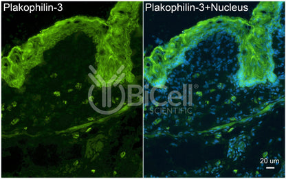Plakophilin-3 (PKP3) Antibody - FFPE Validated