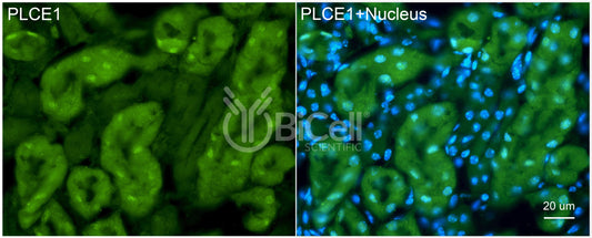 PLCE1 (PLCE) Antibody