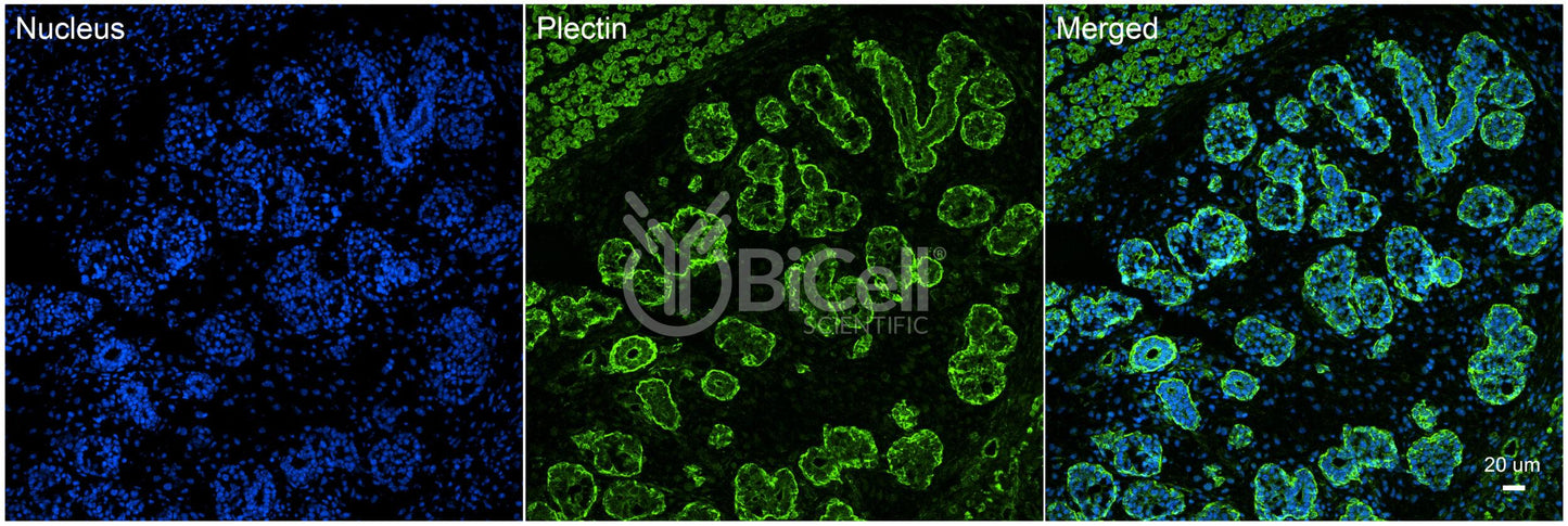 Plectin (PLEC) Antibody - FFPE Validated