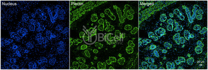 Plectin (PLEC) Antibody - FFPE Validated