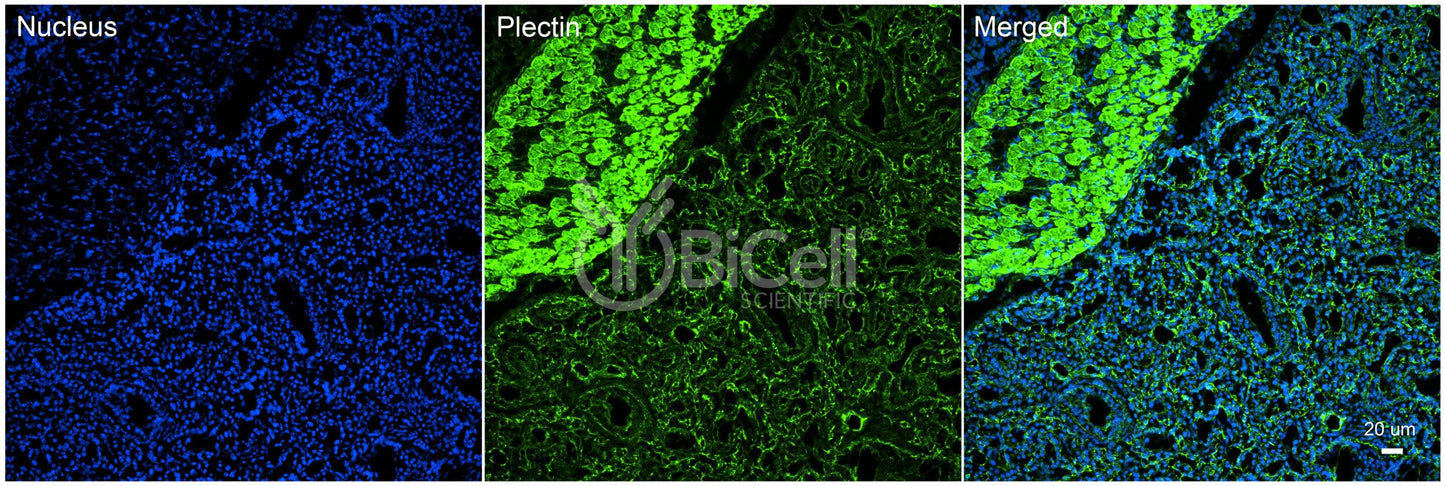 Plectin (PLEC) Antibody - FFPE Validated