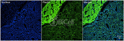 Plectin (PLEC) Antibody - FFPE Validated