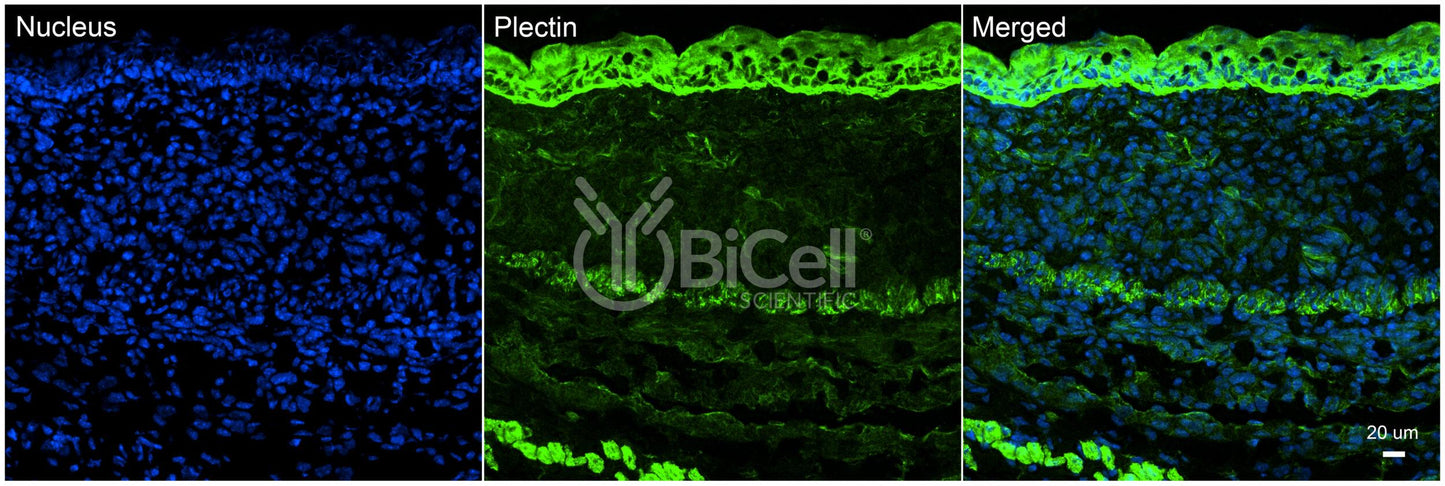 Plectin (PLEC) Antibody - FFPE Validated