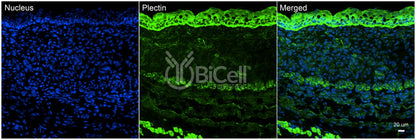 Plectin (PLEC) Antibody - FFPE Validated