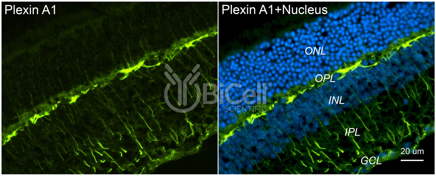 Plexin A1 (PLXNA1) Antibody - FFPE Validated
