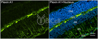 Plexin A1 (PLXNA1) Antibody - FFPE Validated