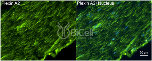 Plexin A2 (PLXNA2) Antibody - Western Blot Validated