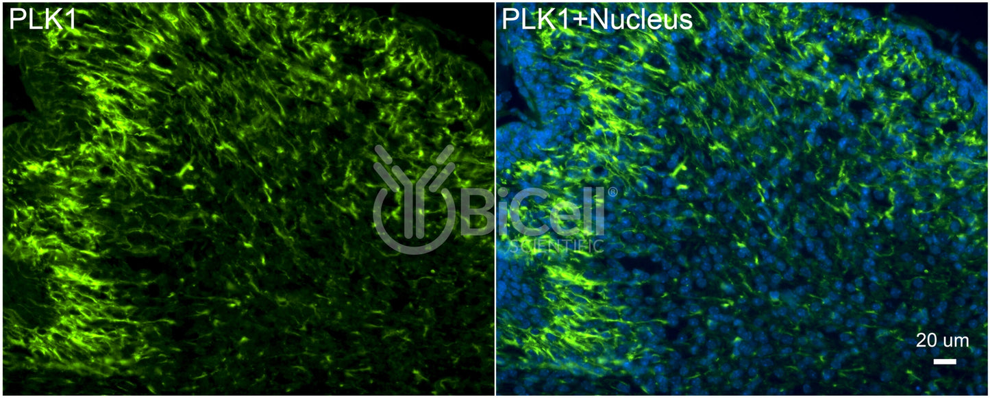 PLK1 (PLK or STPK13) Antibody
