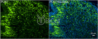 PLK1 (PLK or STPK13) Antibody