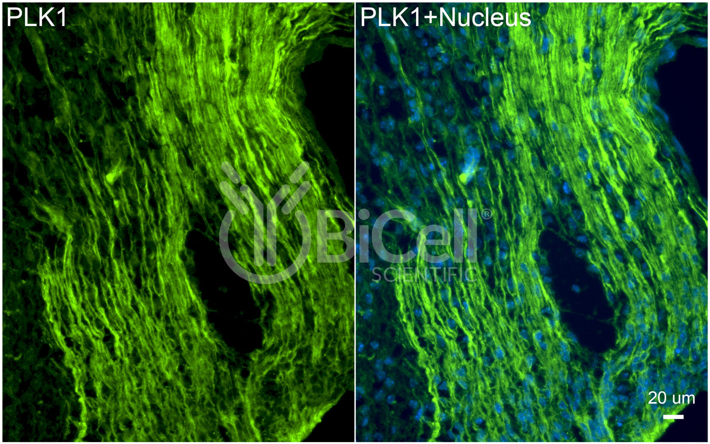 PLK1 (PLK or STPK13) Antibody