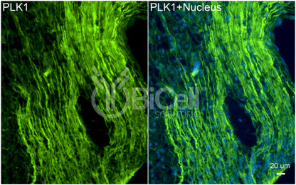 PLK1 (PLK or STPK13) Antibody