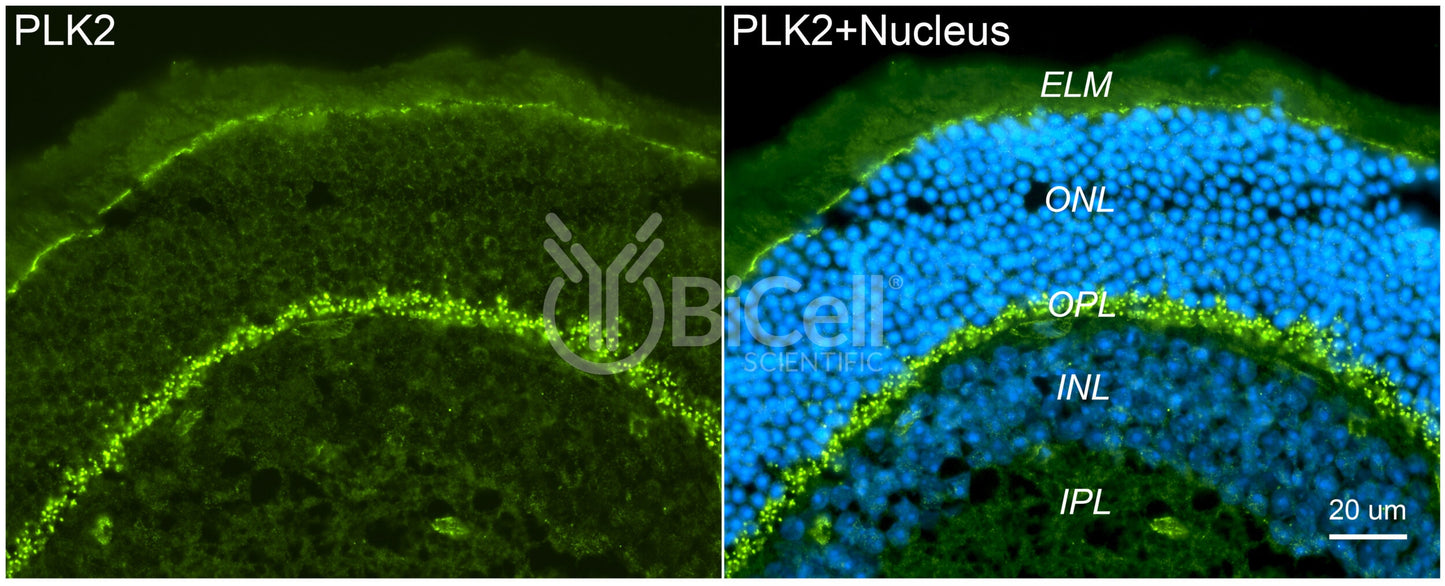 PLK2 (SNK) Antibody - FFPE Validated