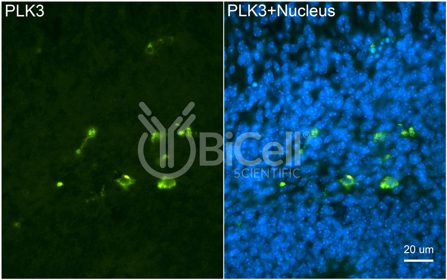 PLK3 (CNK) Antibody - Western Blot Validated