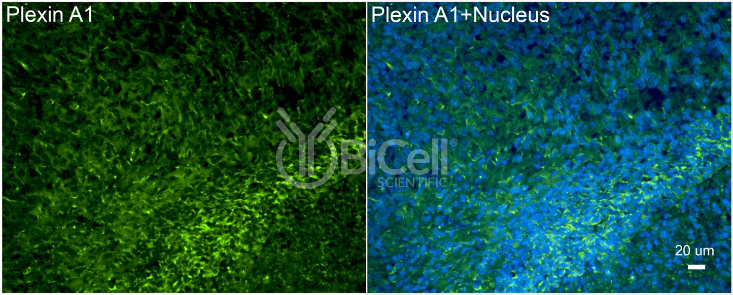 Plexin A1 (PLXNA1) Antibody - FFPE Validated
