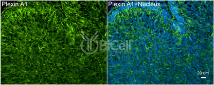 Plexin A1 (PLXNA1) Antibody - Western Blot Validated