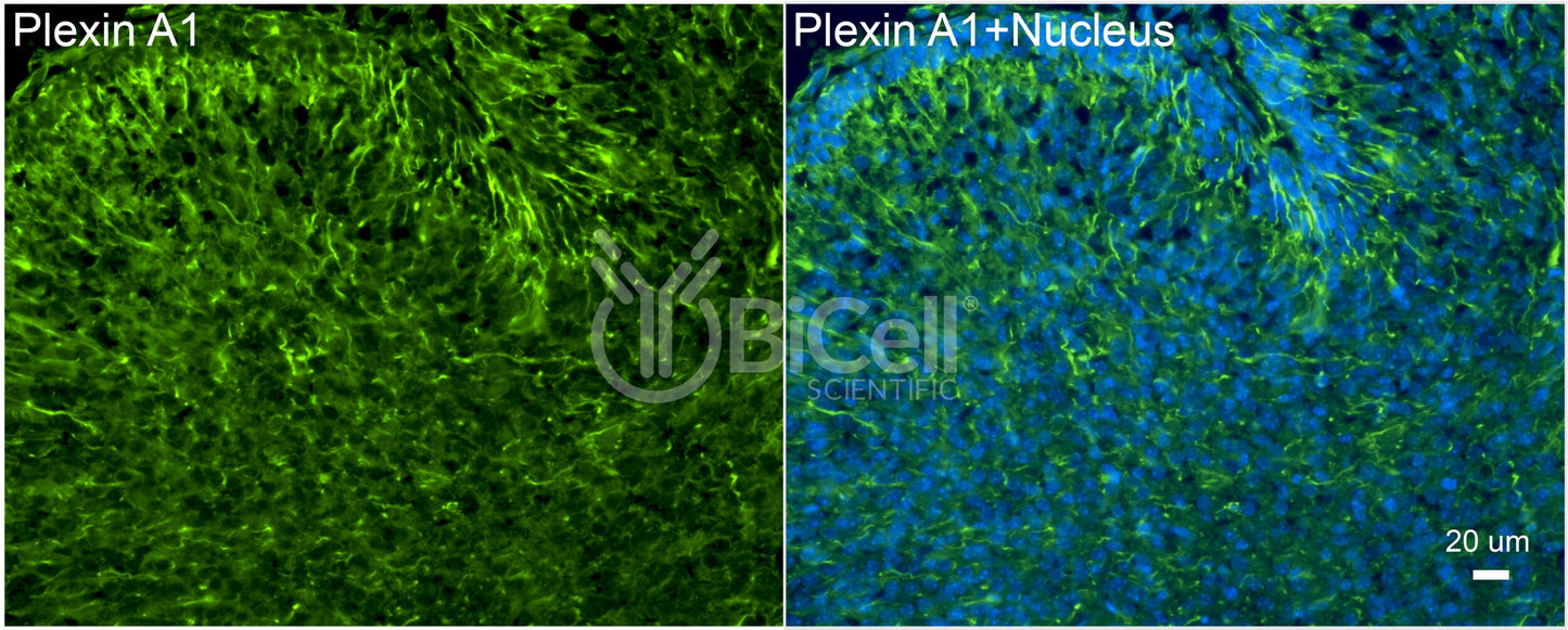 Plexin A1 (PLXNA1) Antibody - FFPE Validated