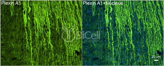 Plexin A1 (PLXNA1) Antibody