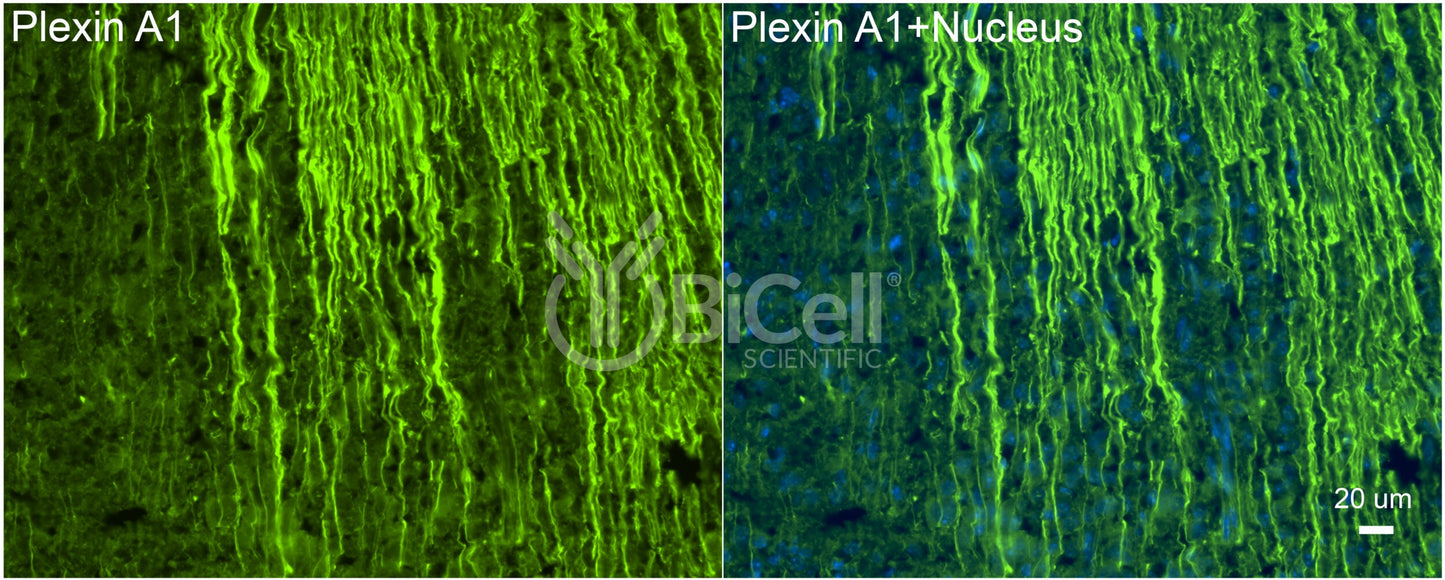 Plexin A1 (PLXNA1) Antibody - FFPE Validated