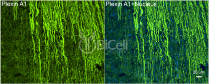 Plexin A1 (PLXNA1) Antibody - FFPE Validated