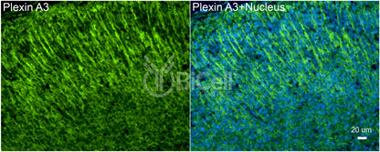 Plexin A3 (PLXNA3) Antibody