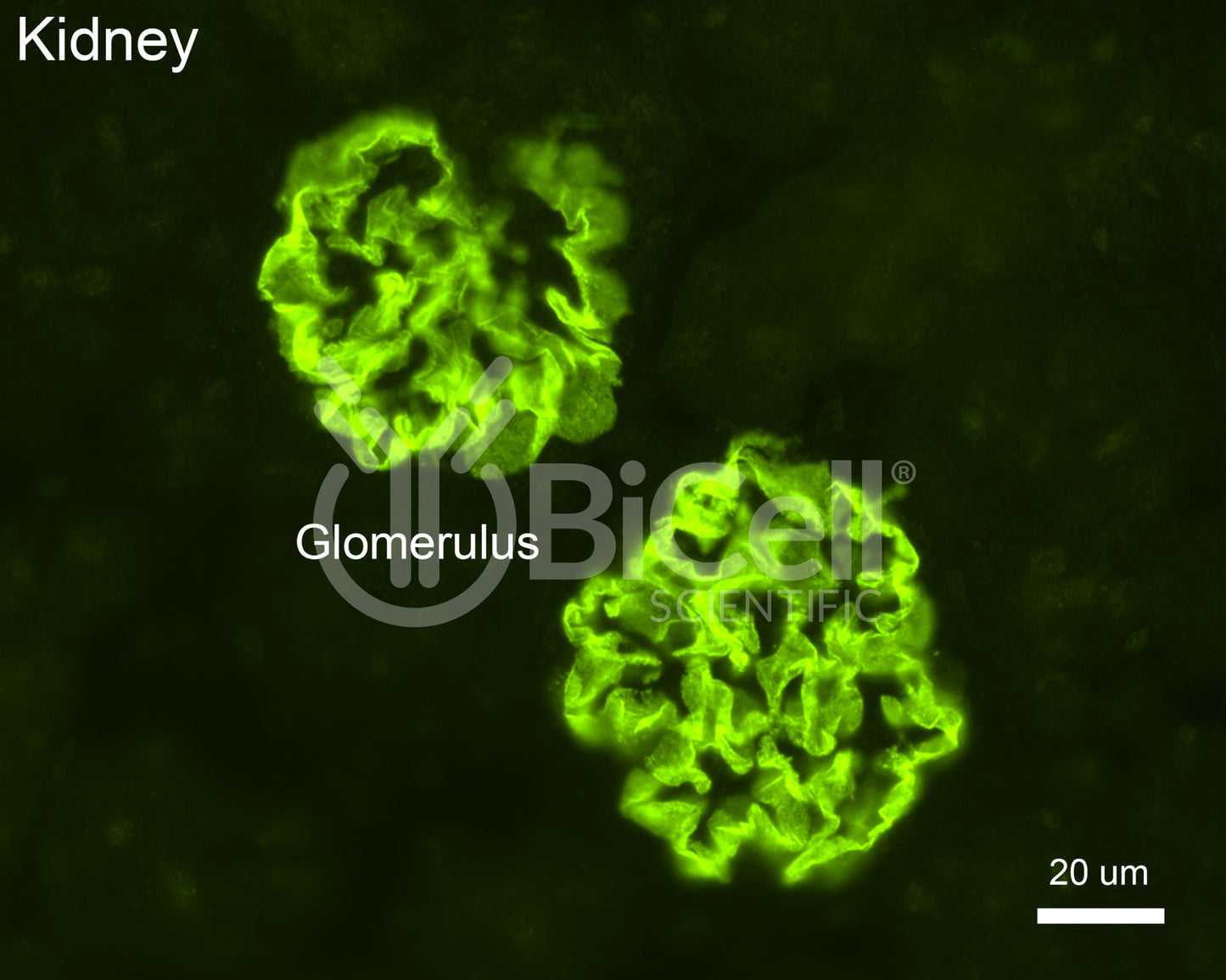 Podocin (Nphs2) Antibody - FFPE Validated