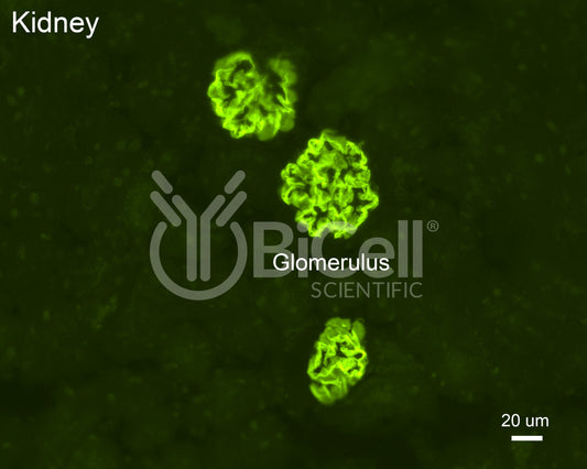 Podocin (Nphs2) Antibody