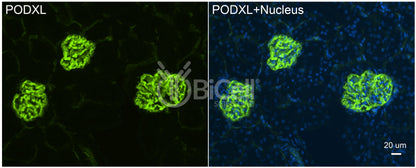Podocalyxin (PODXL or gp135) Antibody - FFPE Validated