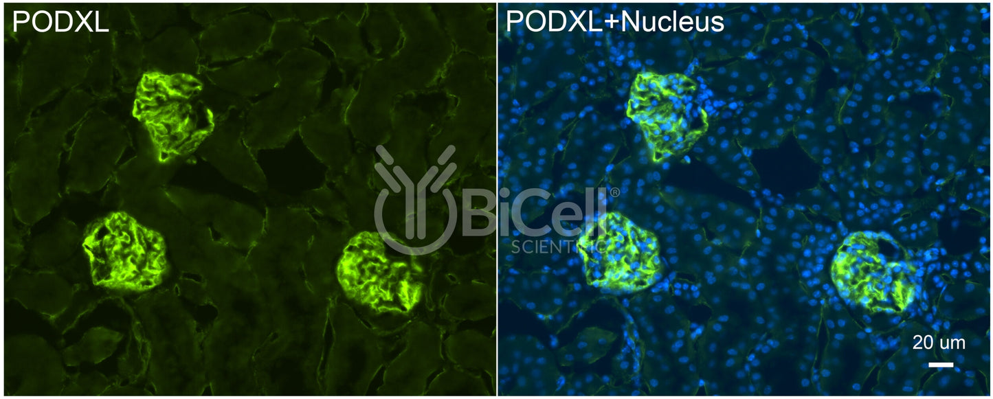 Podocalyxin (PODXL or gp135) Antibody - Western Blot Validated